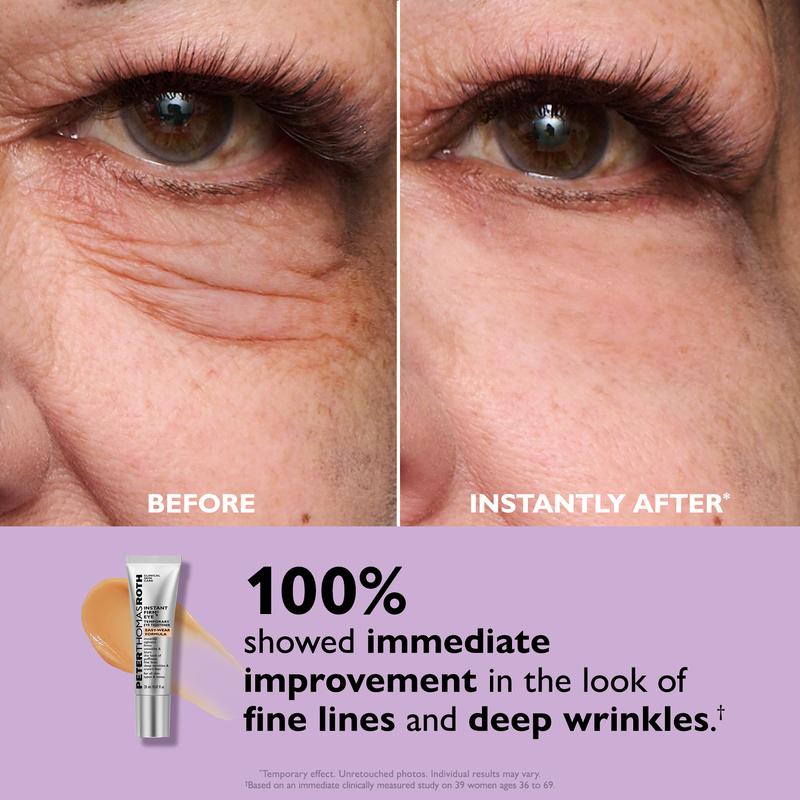 Instant Firm™ – Temporary Eye Tightener (TEST)