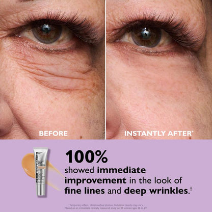Instant Firm™ – Temporary Eye Tightener (TEST)