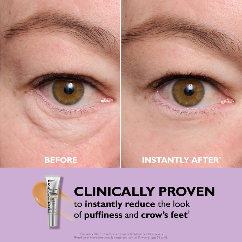Instant Firm™ – Temporary Eye Tightener (TEST)