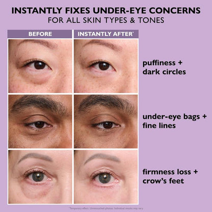 Instant Firm™ – Temporary Eye Tightener (TEST)